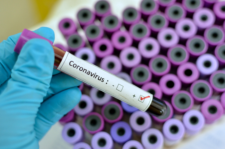 коронавирус, случая, заразени, covid
