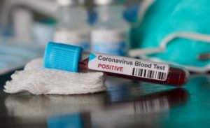Read more about the article „Кошмарна находка“ открили в белия дроб на починалата от коронавирус у нас