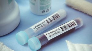 Read more about the article Започва масово тестване за коронавирус в България (ВИДЕО)