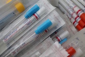 Read more about the article Пускат комбинирани тестове за COVID-19 и грип