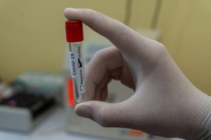 Read more about the article Под 5% положителни проби за коронавирус